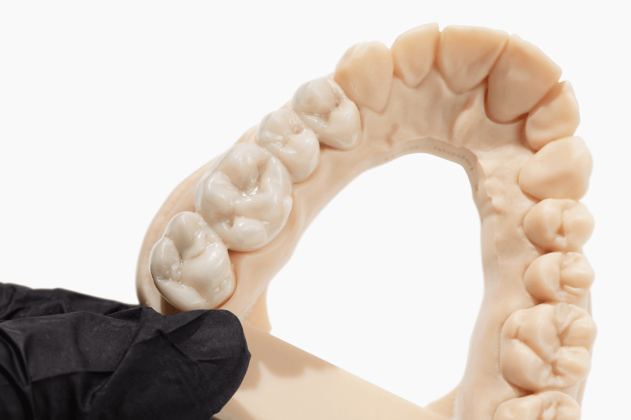 Key Factors Dentists Should Consider When Choosing a Dental Lab