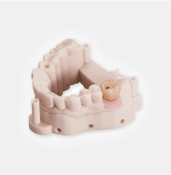 Zirconia vs E-max: Choosing the Right Material for Your Case