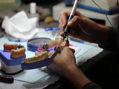 Zirconia Crowns & Bridges