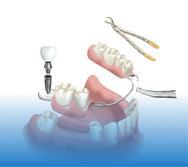 Dental Model